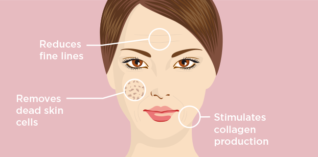 Fresh Skin with Glycolic Acid